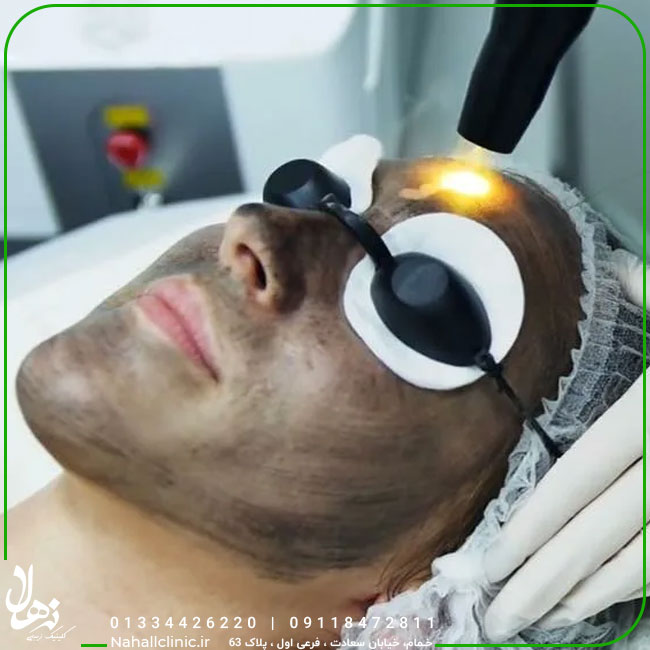 کربن تراپی