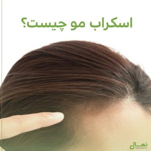 اسکراب مو چیست؟