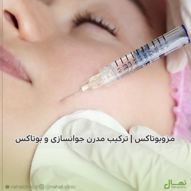 مزوبوتاکس