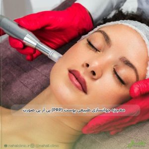 پی-ار-پی-صورت