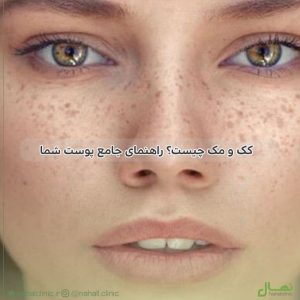 کک و مک چیست؟