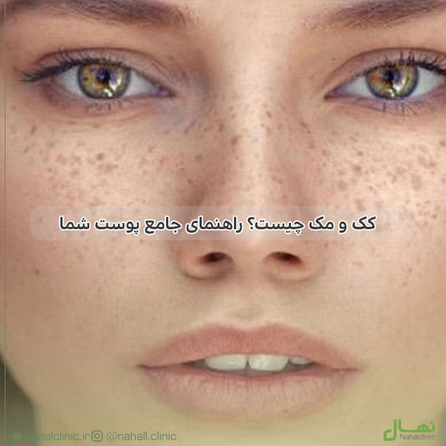 کک و مک چیست؟