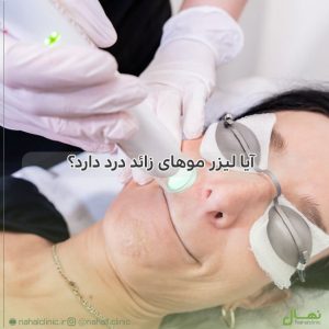آیا لیزر موهای زائد درد دارد؟