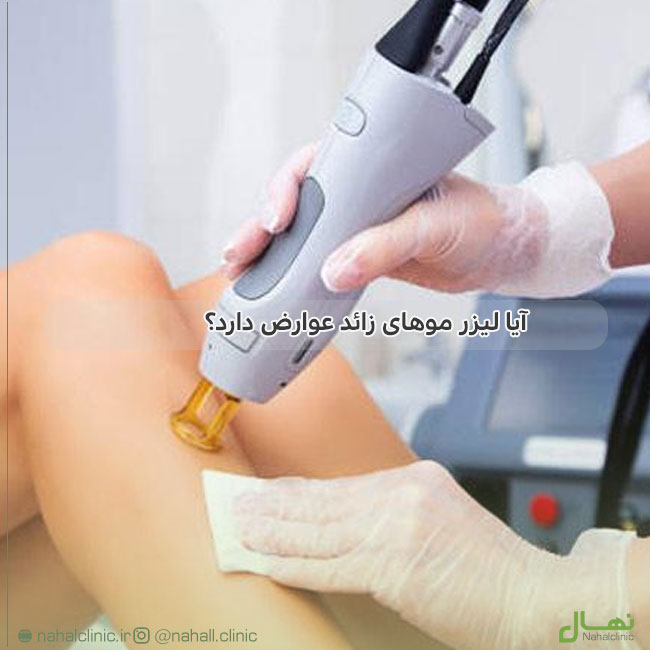 آیا لیزر موهای زائد عوارض دارد؟
