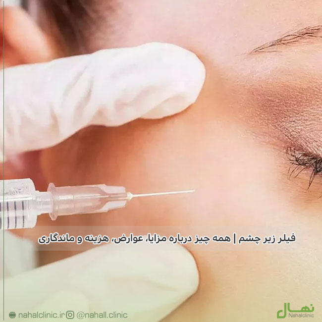 filler-under-eye