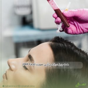 همه چیز درباره پی‌آر‌پی صورت (PRP Face)