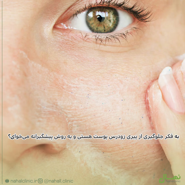جلوگیری-از-پیری-زودرس-پوست