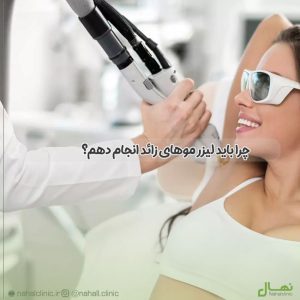 چرا باید لیزر موهای زائد انجام دهم؟