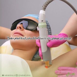 لیزر الکساندر کندلا