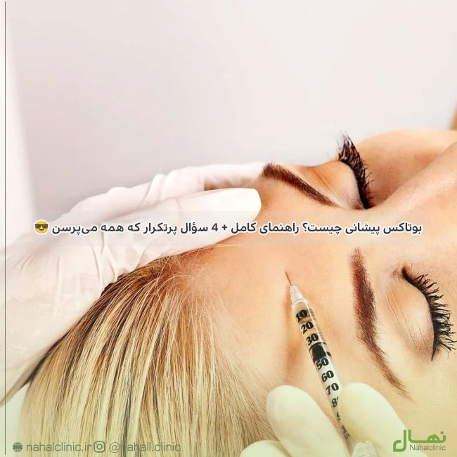 بوتاکس