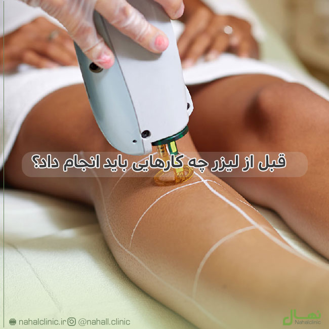 قبل از لیزر چه کارهایی باید انجام داد؟