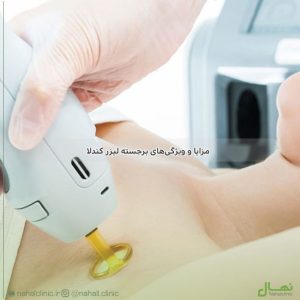 مزایا و ویژگی‌های برجسته لیزر کندلا