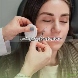 مزوتراپی برای هر نوع پوستی مناسب