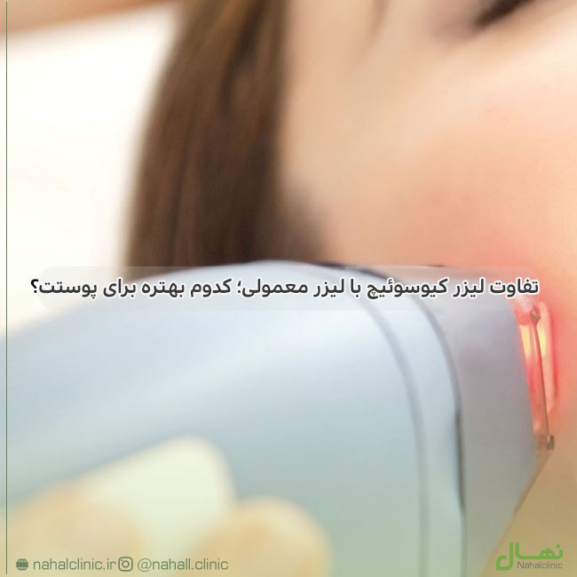 کیوسوئیچ