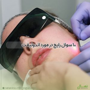 ۱۰ سوال رایج در مورد اندولیفت