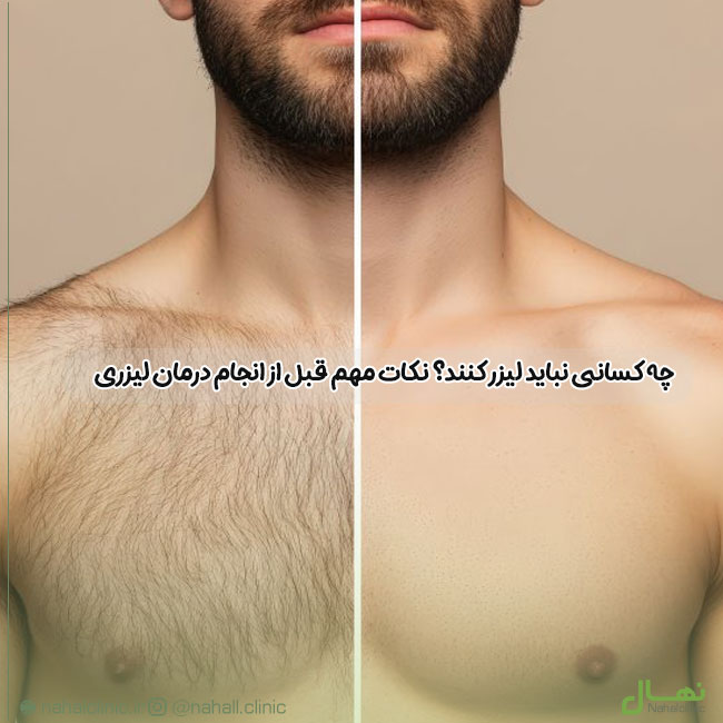 چه کسانی نباید لیزر کنند؟ نکات مهم قبل از انجام درمان لیزری