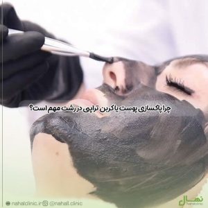 پاکسازی پوست یا کربن تراپی