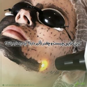 کربن تراپی چیست