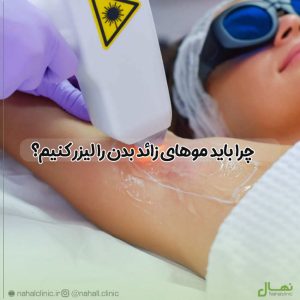 چرا باید موهای زائد بدن را لیزر کنیم؟