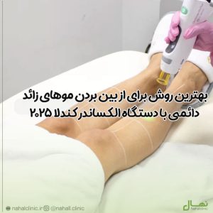 بهترین روش برای از بین بردن موهای زائد دائمی با دستگاه الکساندر کندلا 2025