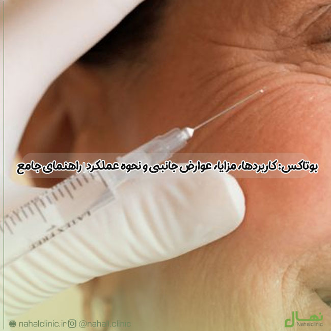 بوتاکس