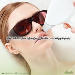 لیزر موهای پشت لب — راهنمای کامل، مزایا، معایب و نکات مهم