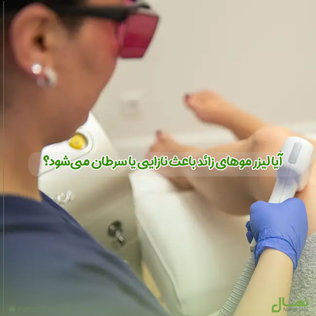 آیا لیزر موهای زائد باعث نازایی یا سرطان میشود؟ | بررسی علمی و پزشکی