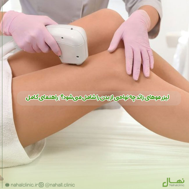 Laser Hair Removal