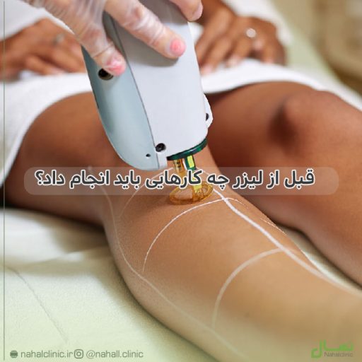 قبل از لیزر چه کارهایی باید انجام داد؟