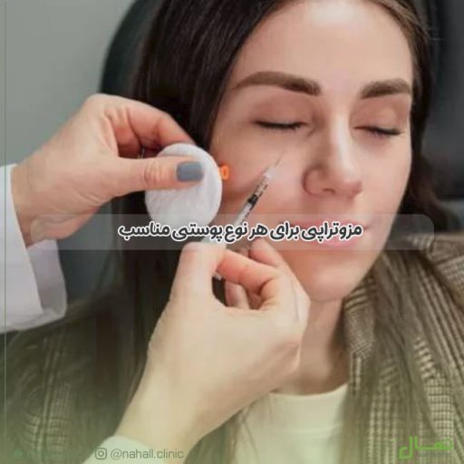 مزوتراپی برای هر نوع پوستی مناسب