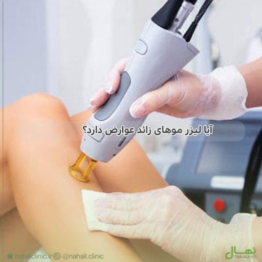 آیا لیزر موهای زائد عوارض دارد؟