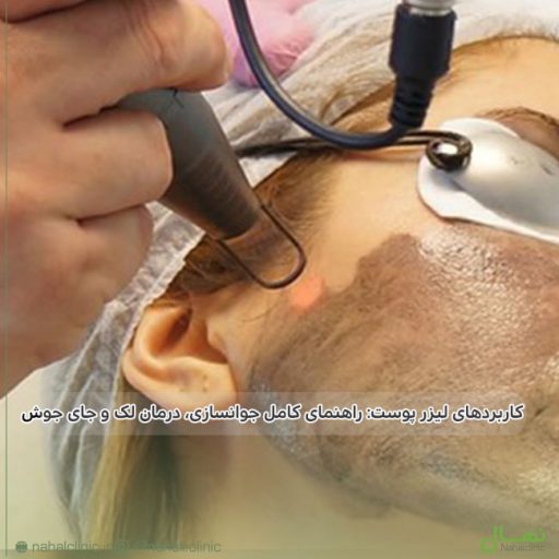 کاربردهای لیزر پوست