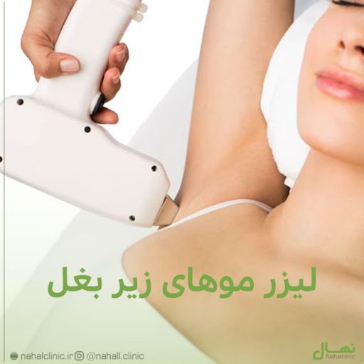 لیزر موهای زیر بغل