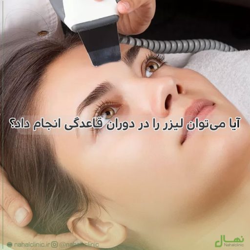 آیا می‌توان لیزر را در دوران قاعدگی انجام داد؟