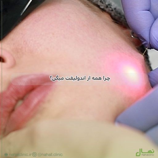 چرا همه دنبال اندولیفت هستن؟