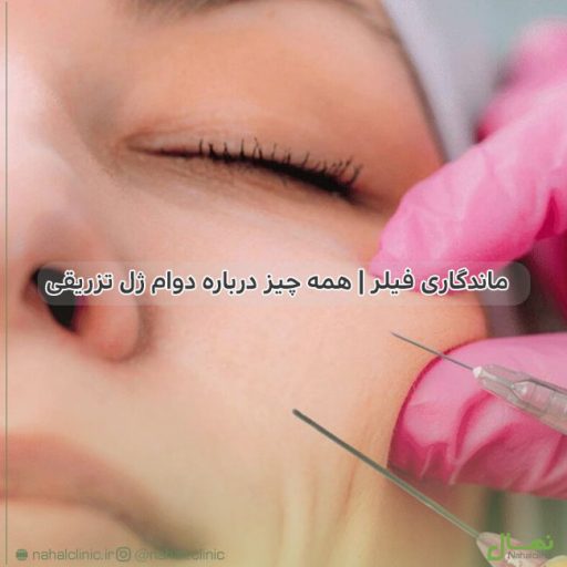 ماندگاری فیلر