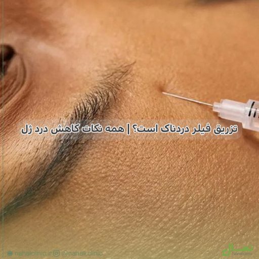 تزریق فیلر دردناک است؟ | همه نکات کاهش درد ژل