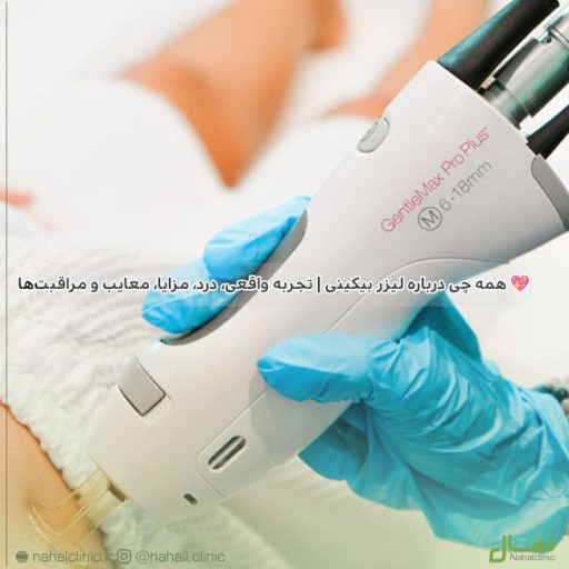 لیزر بیکینی