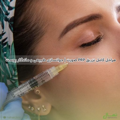 PRP پوست صورت