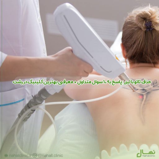 حذف تاتو با لیزر | پاسخ به 10 سوال متداول + معرفی بهترین کلینیک در رشت