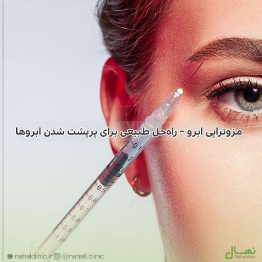 مزوتراپی ابرو