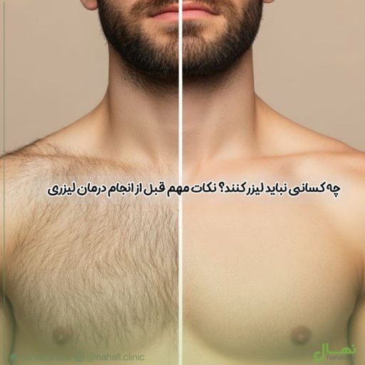 چه کسانی نباید لیزر کنند؟ نکات مهم قبل از انجام درمان لیزری