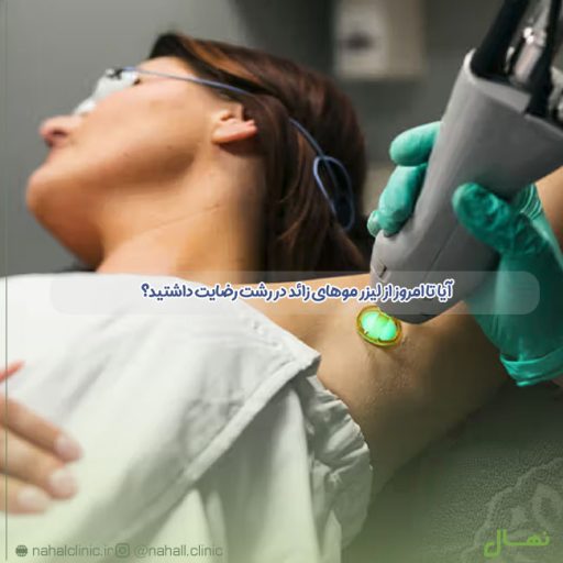 آیا تا امروز از لیزر موهای زائد در رشت رضایت داشتید؟