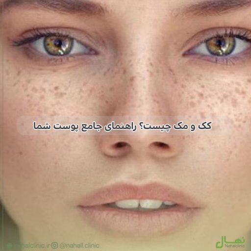 کک و مک چیست؟