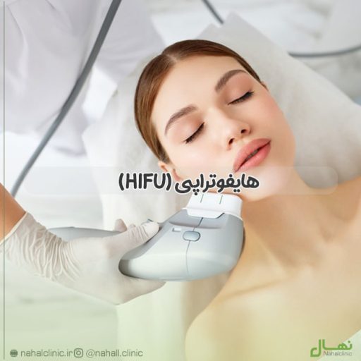 هایفوتراپی (HIFU)