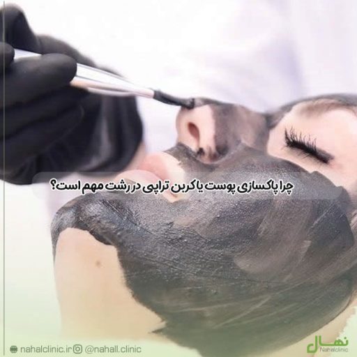 پاکسازی پوست یا کربن تراپی