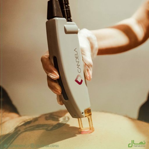 best-laser-clinic-rasht