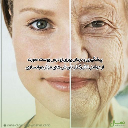 پیشگیری و درمان پیری زودرس پوست صورت