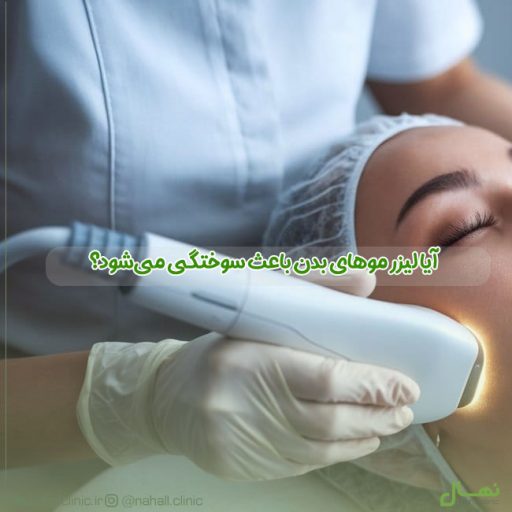 آیا لیزر موهای بدن باعث سوختگی می‌شود؟