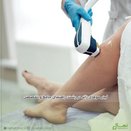 لیزر موهای زائد در رشت: راهنمای جامع و تخصصی